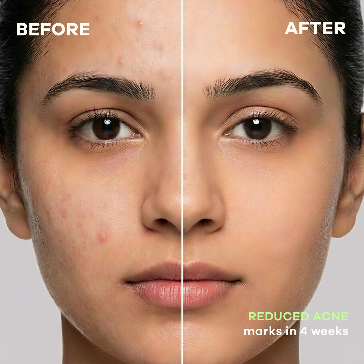 Healing Cica Gel, Calms Redness and Fades Acne Scars in 4 Weeks | FC3 - view 4