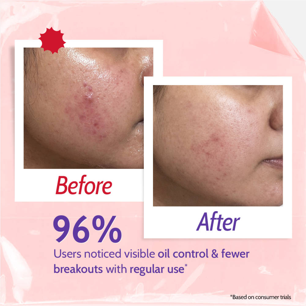 2% Salicylic Acid Face Wash For Oily Skin with Niacinamide Oil Cleanser for Face | FC3 - view 5