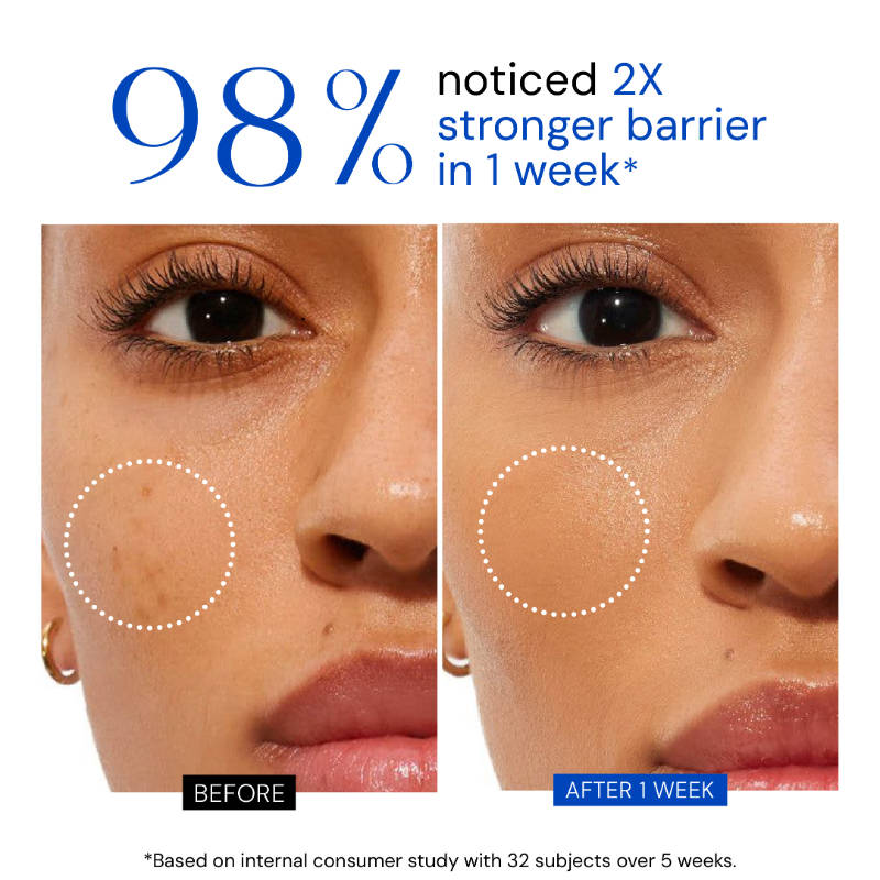 Balanced Barrier Creme with 5 Ceramides Complex+ Collagen+ Peptide for Damage Skin Barrier | FC3 - view 4