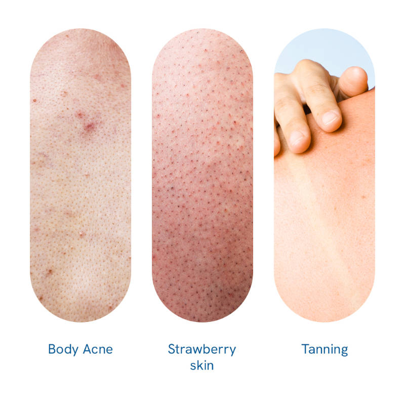 10% AHA Lactic Acid Body Scrub | BWS9 - view 5