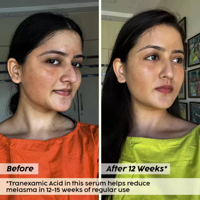 5% Pineapple Foaming Face Wash And Serum | PL1 - view 10