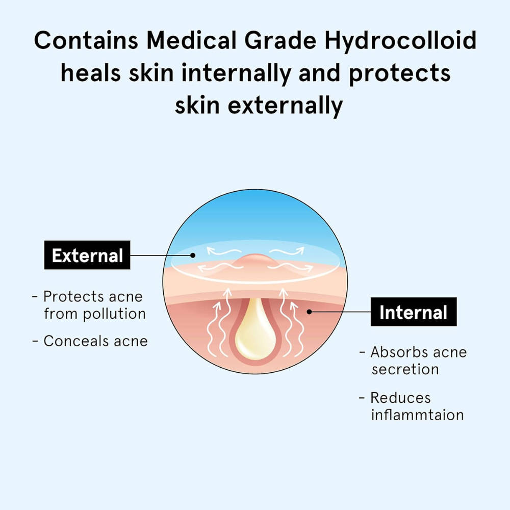 Hydrocolloid Acne Pimple Patch Absorbs & Flattens Acne Overnight | BWS9 - view 6