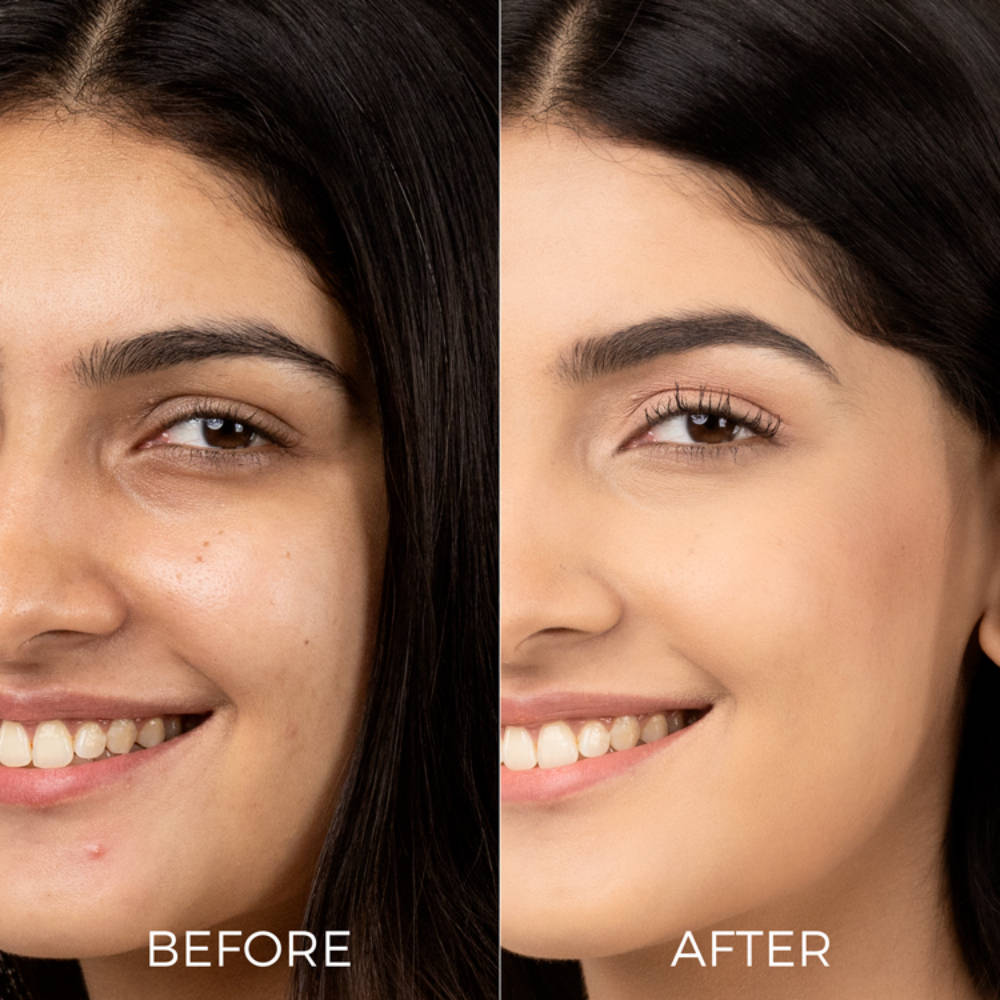 10% Vitamin C Face Serum for Glowing Skin with Probiotics Visible Glow in Just 7 Days | Z8 - view 5