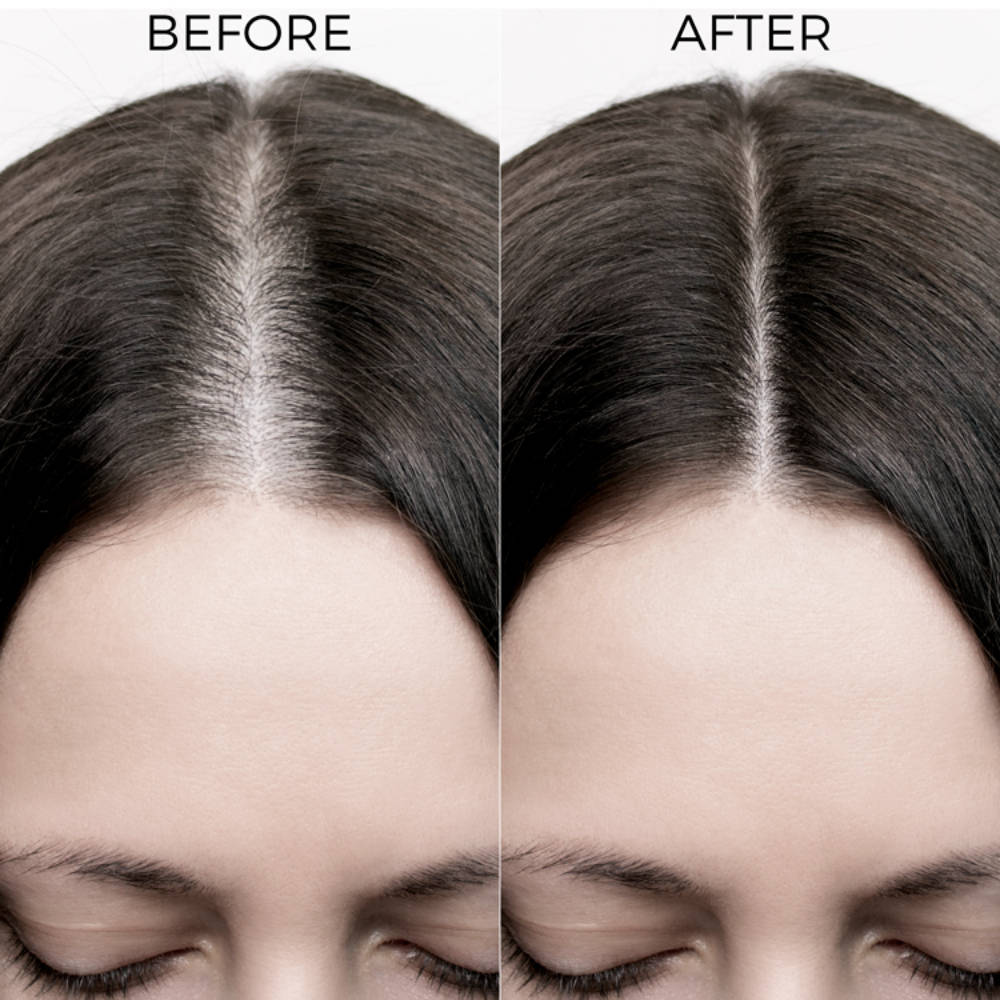 10% Rosemary Hair Oil for Hair Growth Reduces Hair Fall & Strengthens Hair | H85 - view 5