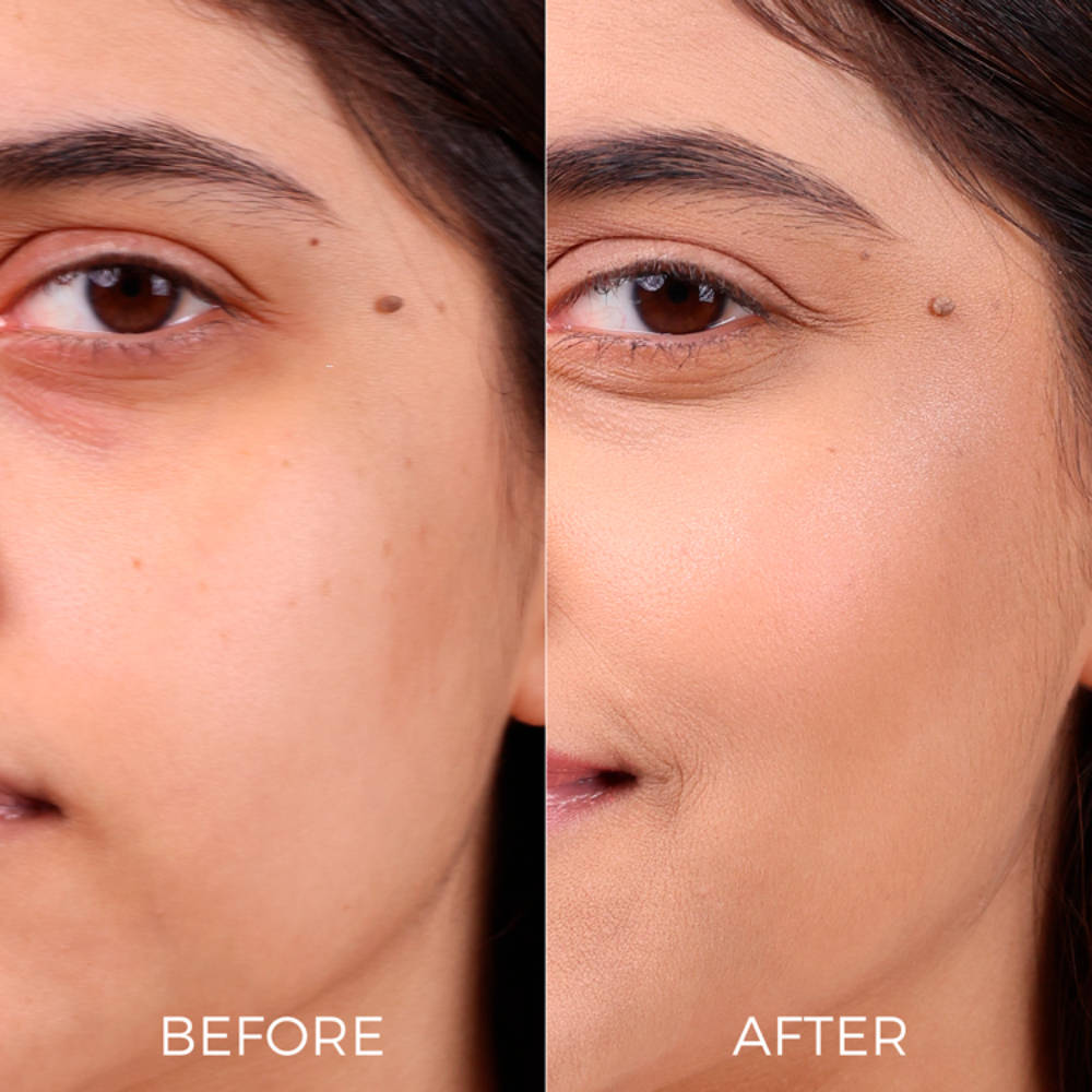 10% Niacinamide Face Serum for Oily & Acne Prone Skin Reduces Dark Spots & Open Pores | Z8 - view 5