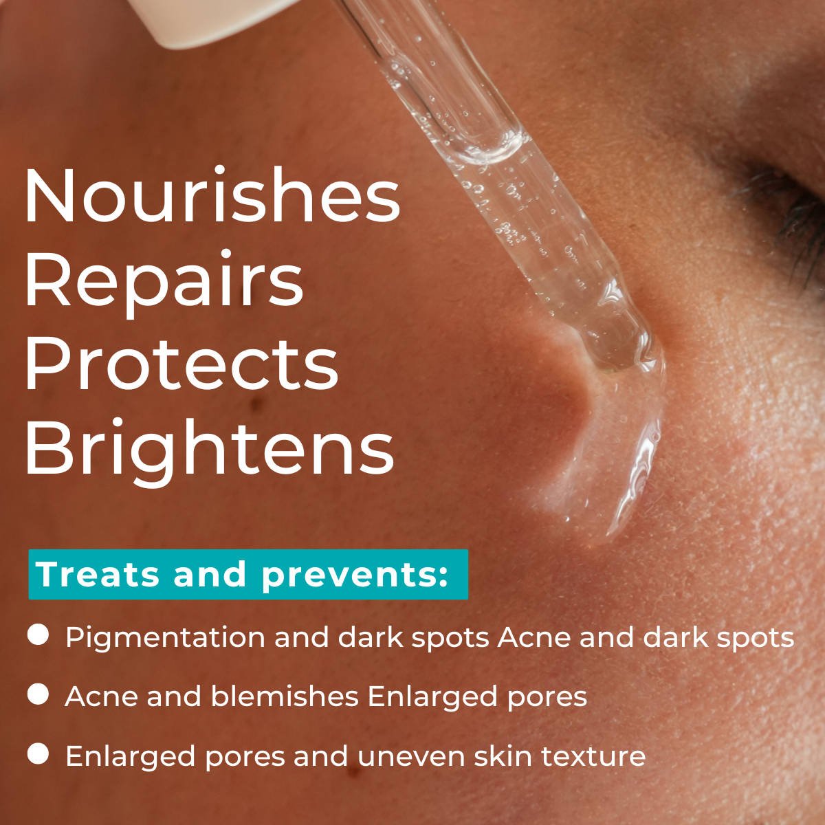 CEO face Serum for Acne, Pigmentation & Pores Niacinamide, Alpha Arbutin, Peptides | Z8 - view 3