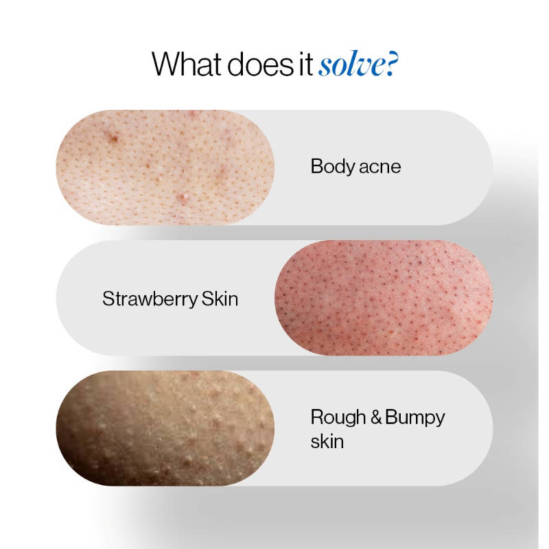 1% Salicylic Acid Body Wash - Prevents Body Acne - SLS & Paraben Free - Pack of 3 | BWS9 - view 3