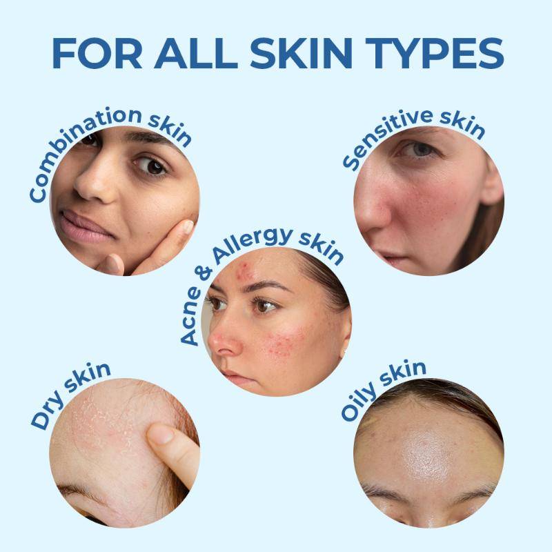 Moisturising Face & Body Lotion For Dry, Aging, Wrinkles, Acne, Red Skin With Vitamin E | B20 - view 3
