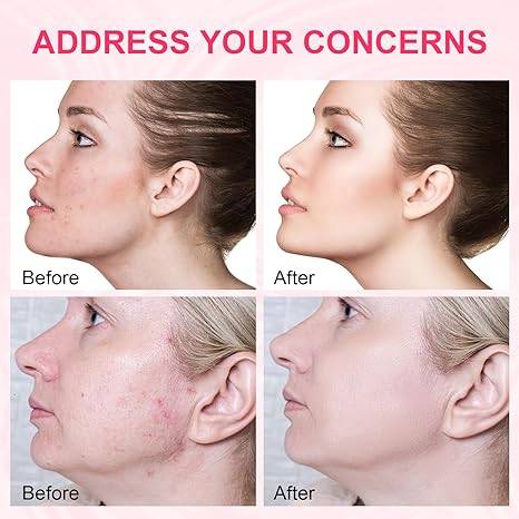 PDRN Pink One Day Serum - Pack of 10 | Z8 - view 3