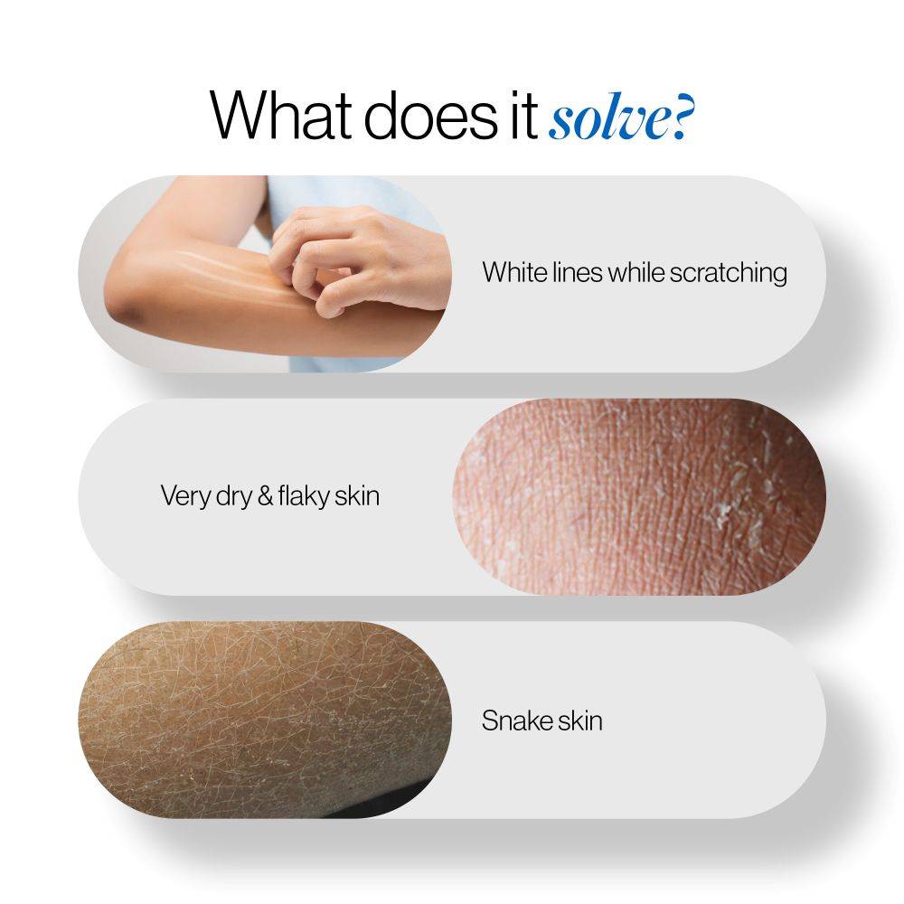20% Urea Body Lotion - Advanced Formulation | BWS9 - view 2