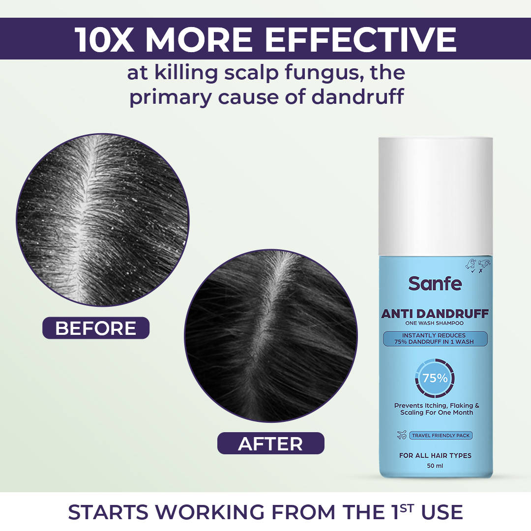 Anti Dandruff One Wash Shampoo | H02 - view 2