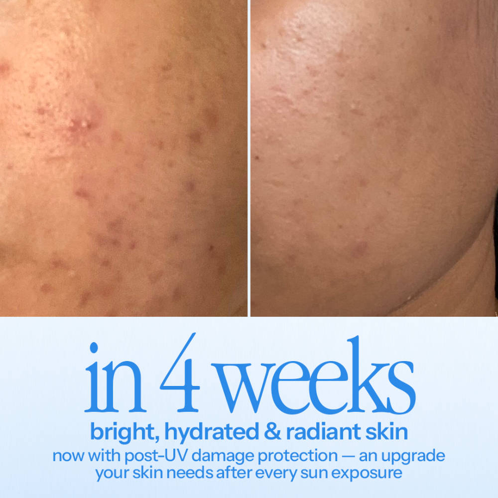 Hustle Serum With 5% Niacinamide, Hyaluronic Acid, Vitamin C For Acne & Pigmentation | Z8 - view 5