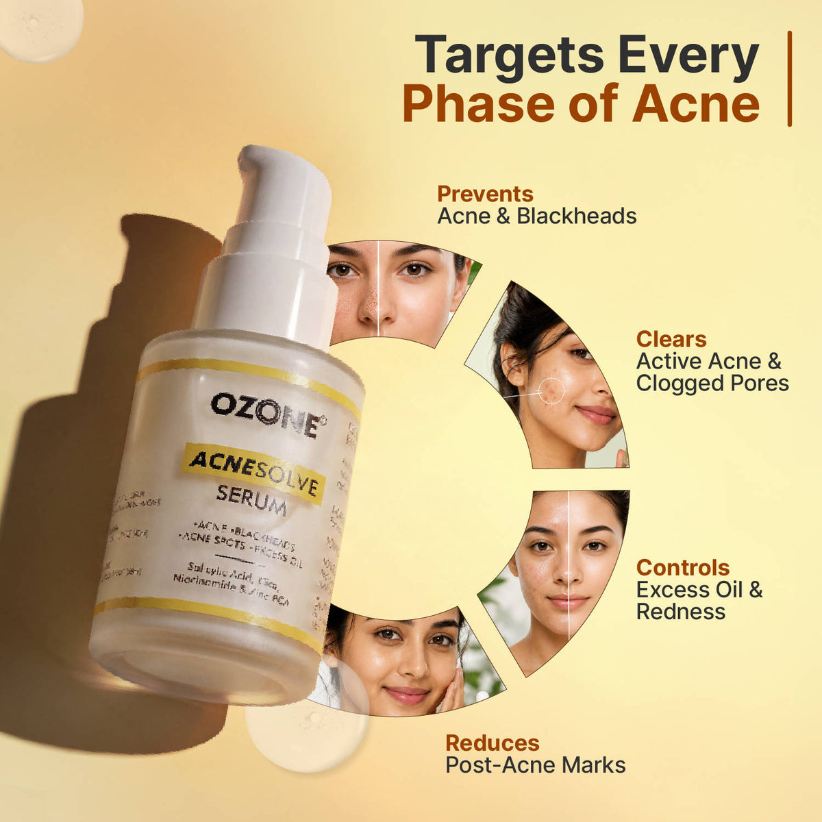 Acnesolve Serum | Z8 - view 4