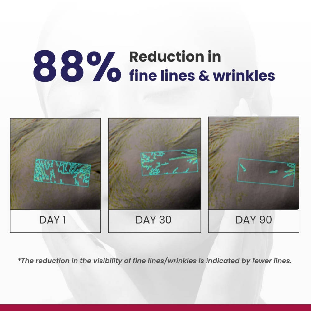 0.1% Retinol Night Creamtreat For Wrinkles & Skin Tightening | FC3 - view 5
