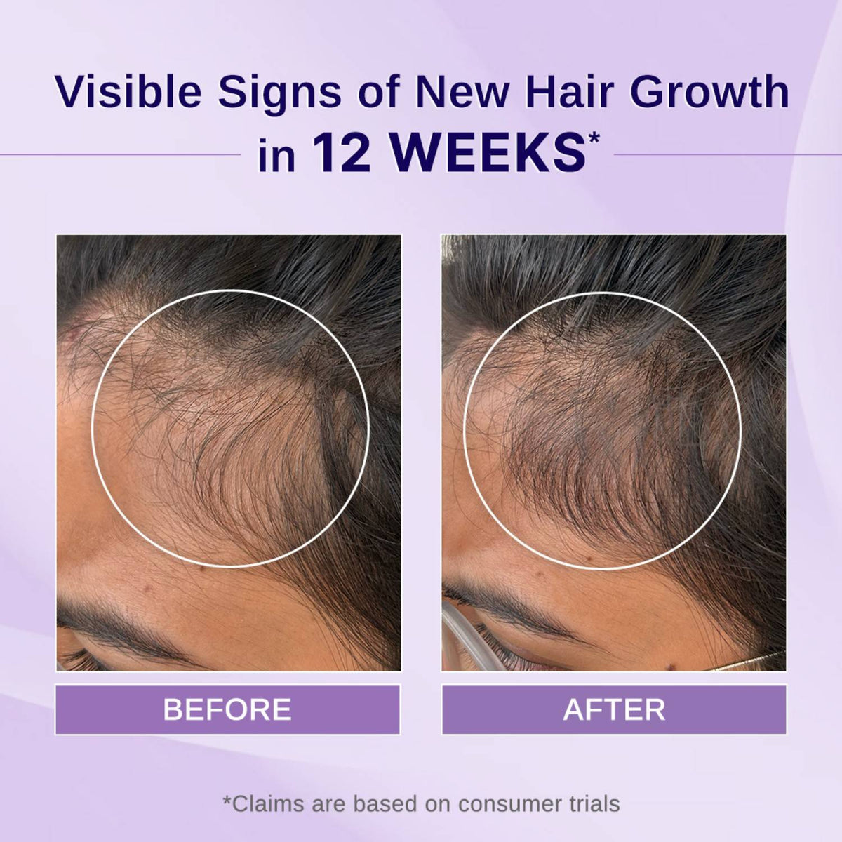 Rosemary Hibiscus Hair Growth Oil | Nourishes, Strengthens & Controls Hair Fall | H85 - view 2