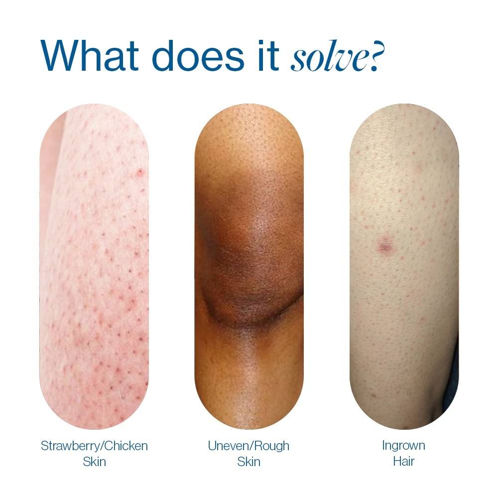 7% Glycolic Acid Stick Body Exfoliation For Smooth, Clear & Even Skin | BWS9 - view 3