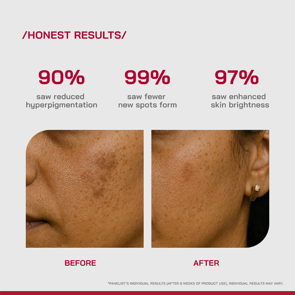 PHD 2% Alpha Arbutin Serum | Z8 - view 4