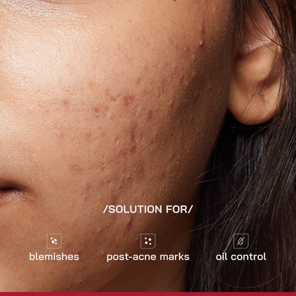 PHD 10% Niacinamide Spot Correcting Serum | Z8 - view 3