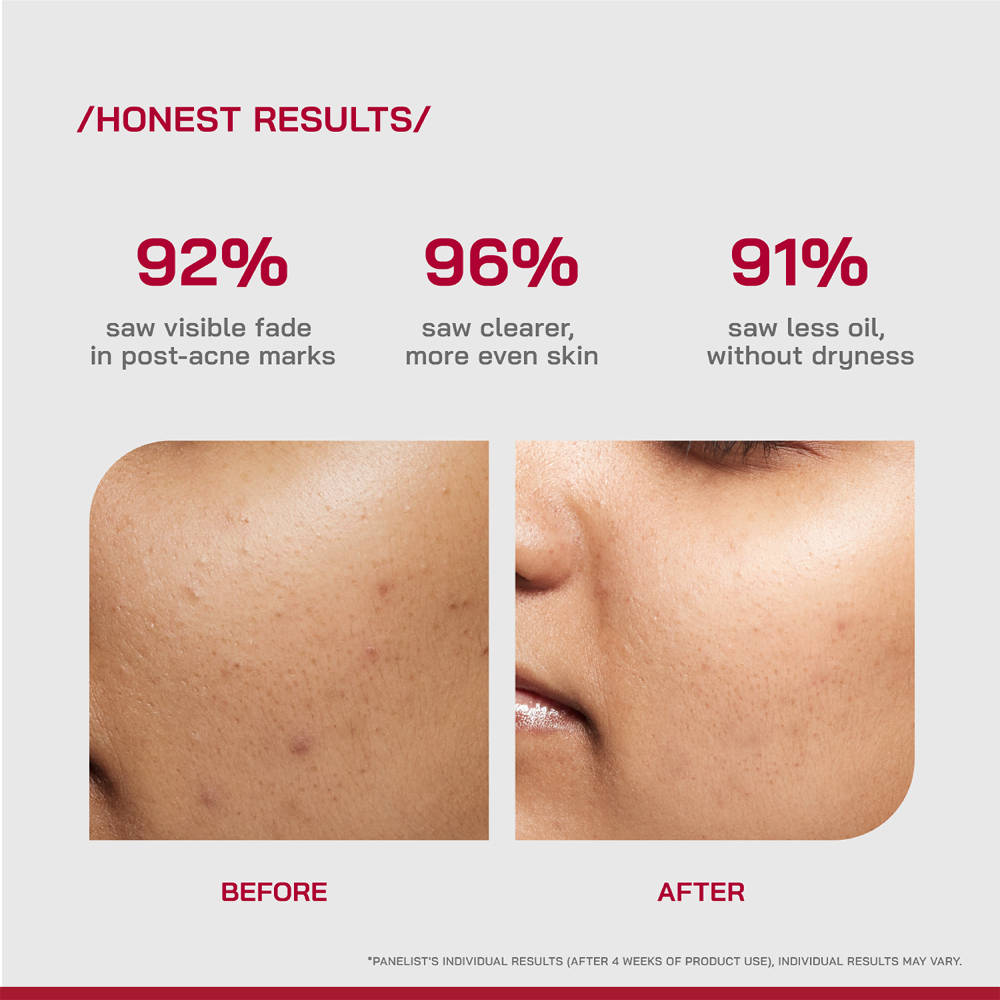 PHD 10% Niacinamide Spot Correcting Serum | Z8 - view 4