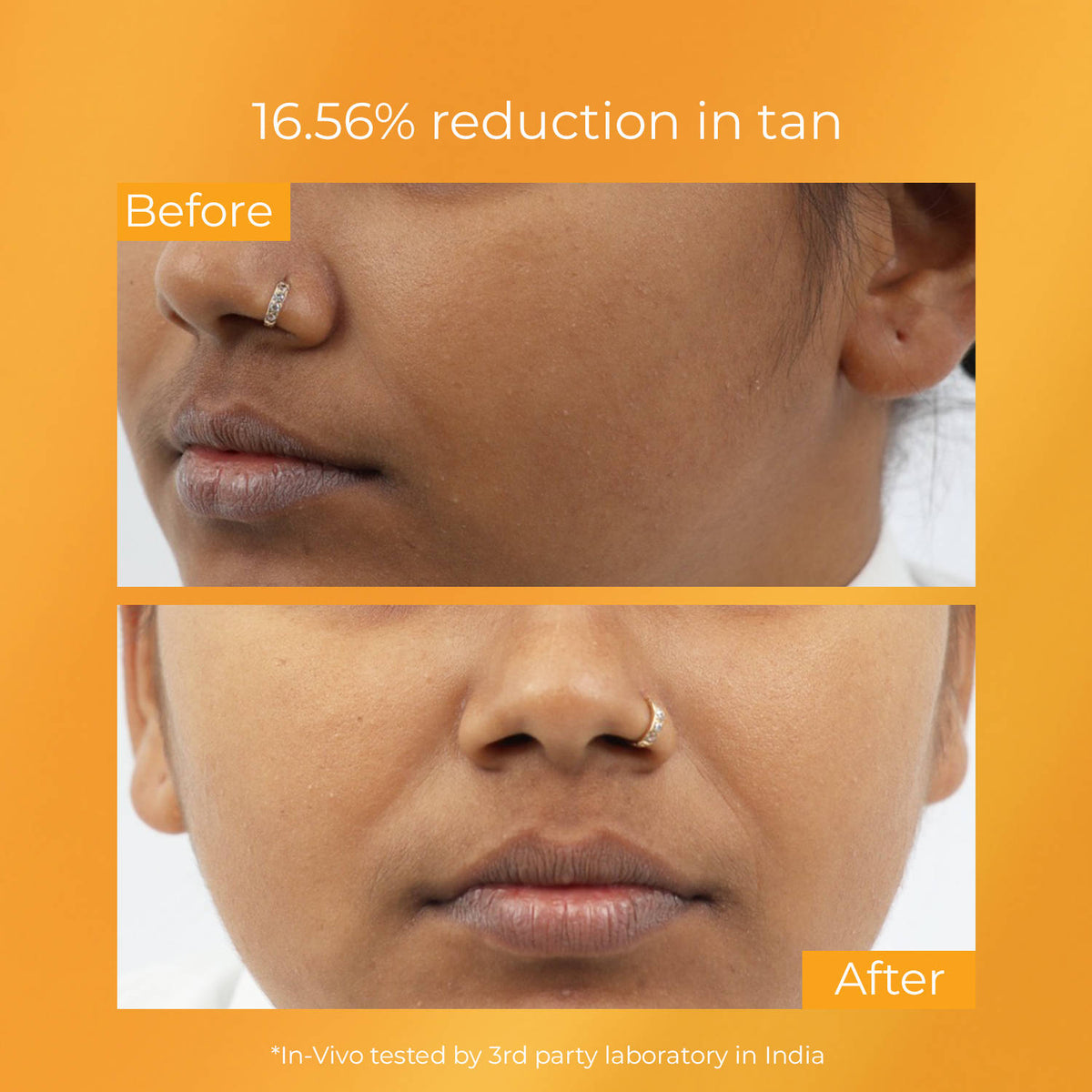 15% Vitamin C Detan Face Serum for Dark Spots & Dull Skin, Brightens & Evens Skin Tone | Z8 - view 3