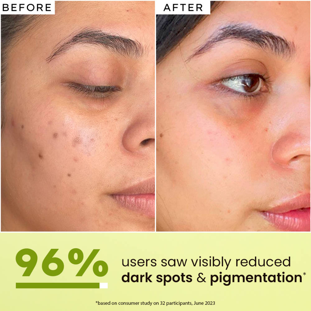 Golden Hour Glow Serum 56% Glow Hyphened All Skin Types | Z8 - view 5