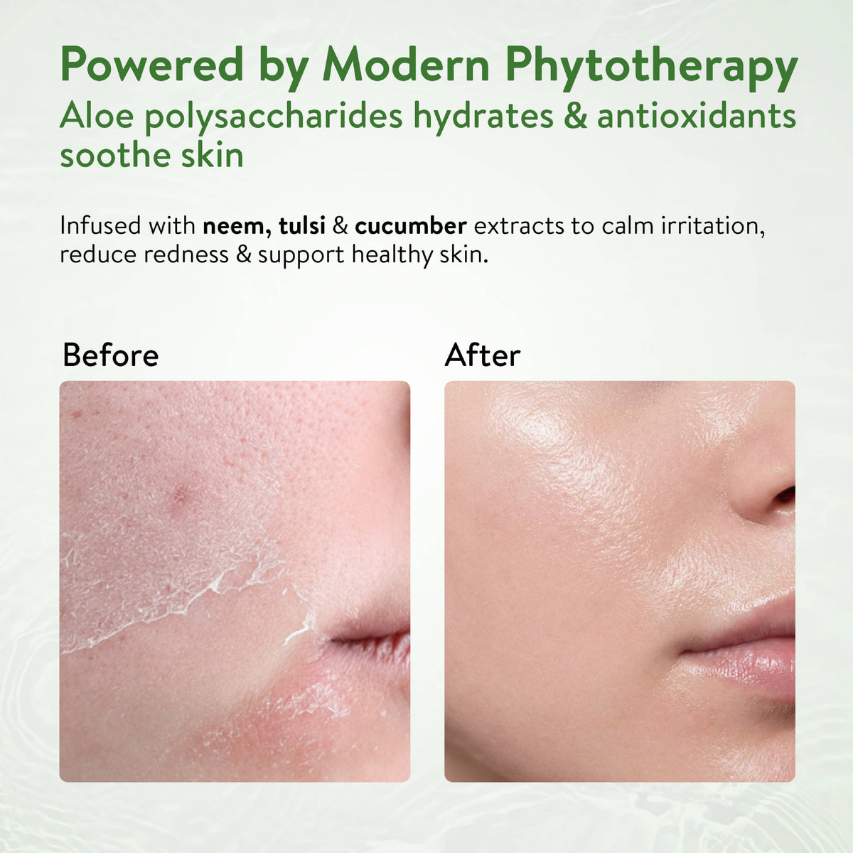 95% Pure Aloe Vera Gel - Multipurpose Hydration For Skin, Body & Hair | H02 - view 5