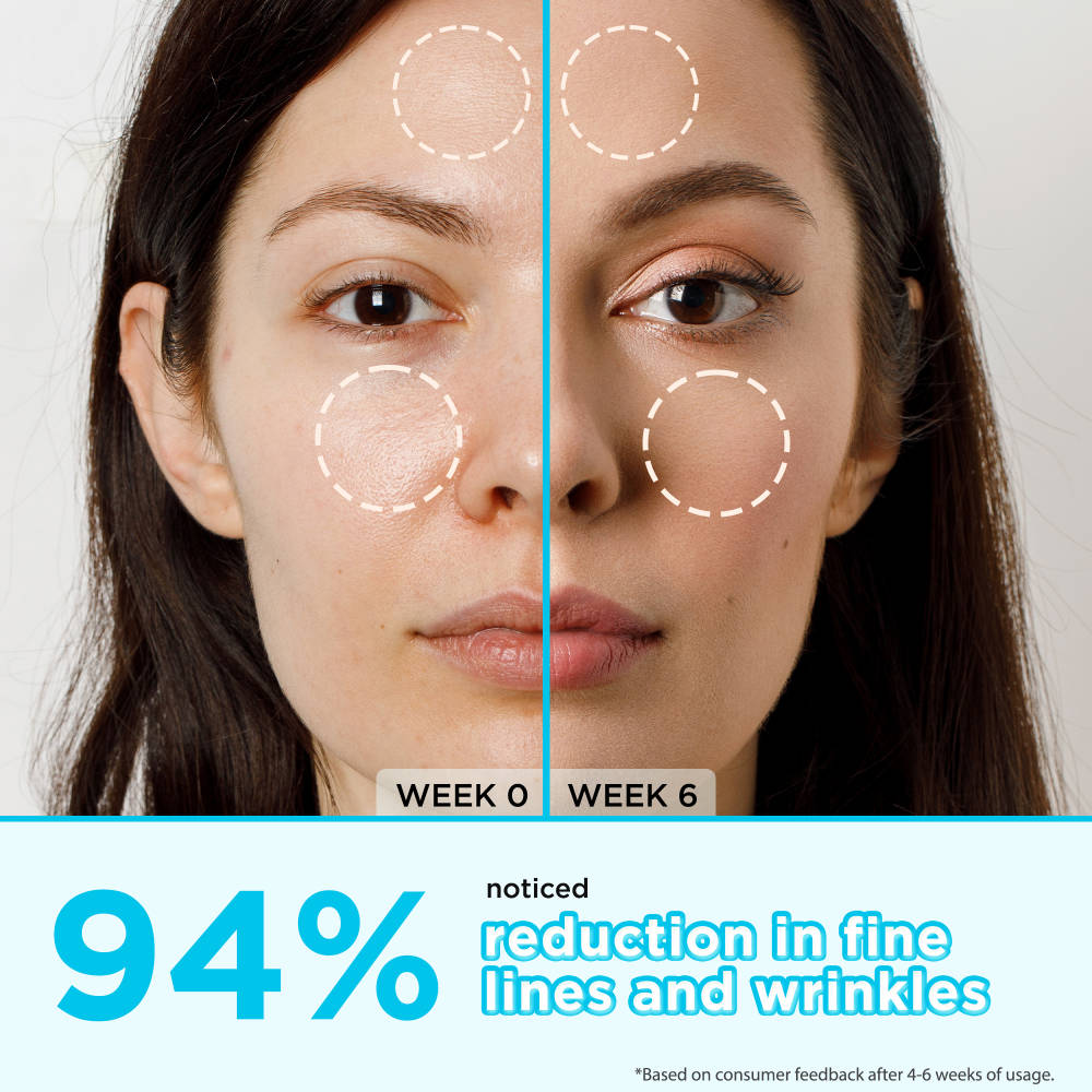 Retinol Anti-Aging Face Serum - Reduces Fine Lines, Boosts Collagen, Hydrates & Skin Firming | Z8 - view 5