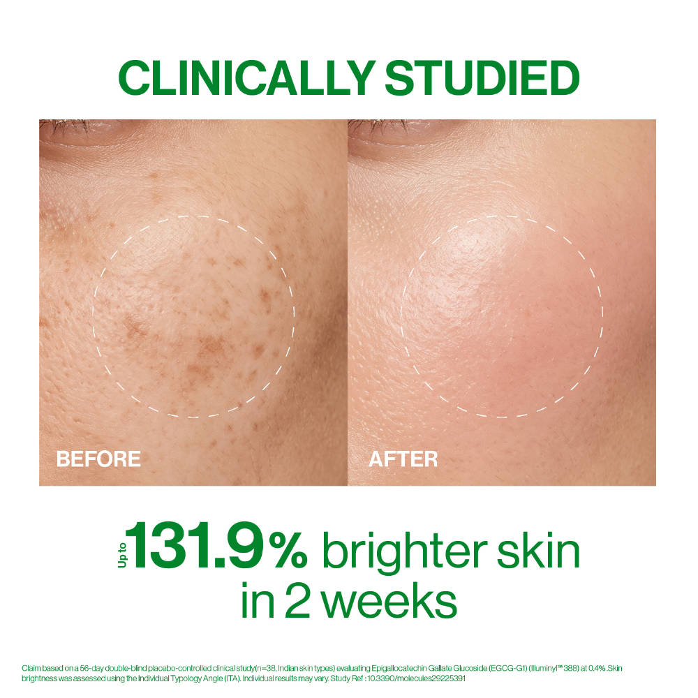 Gluta Brightening Serum For Glowing Skin & Reduced Pigmentation | Z8 - view 4