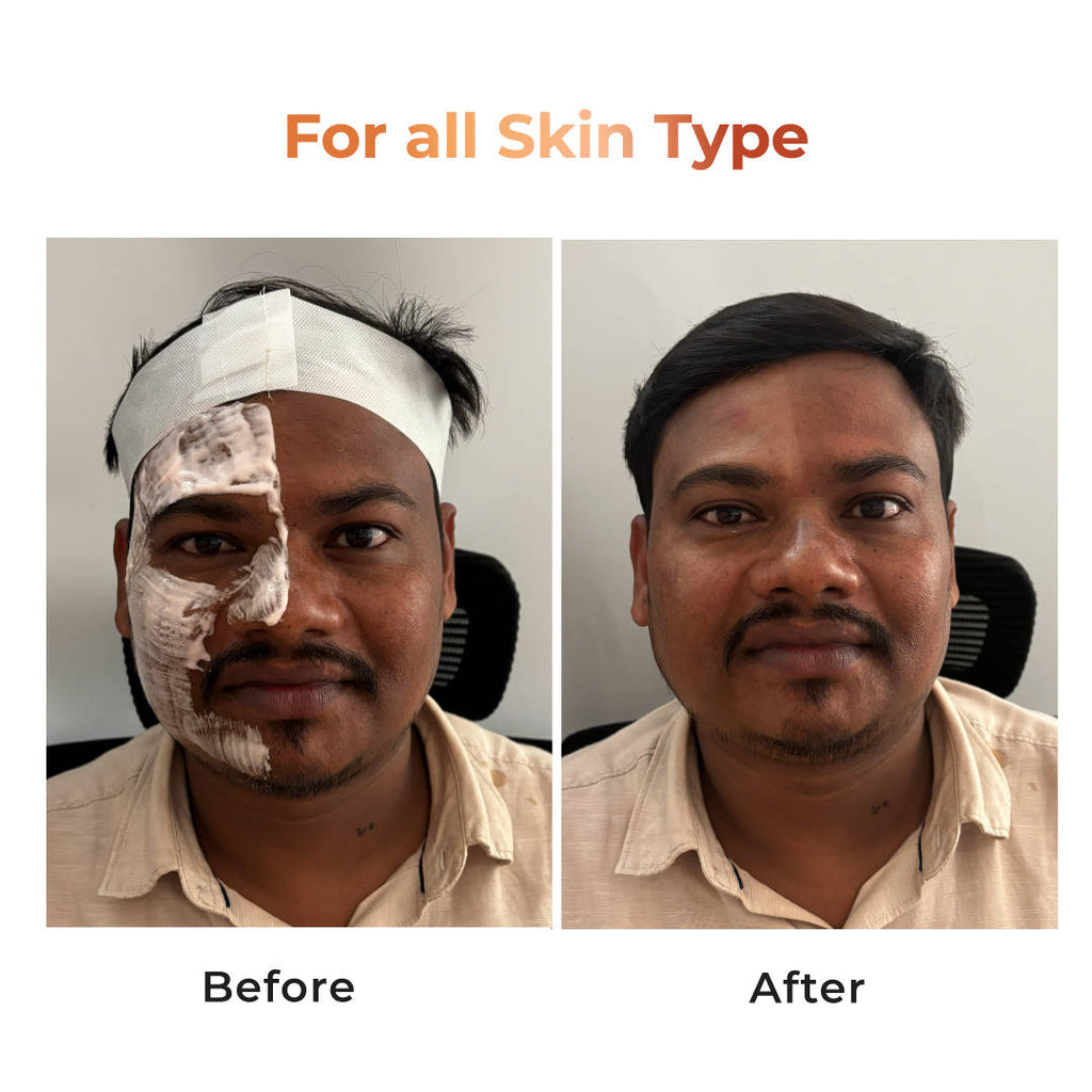 Tan Vanish Gluta-Kojic Skin Polish | B20 - view 6