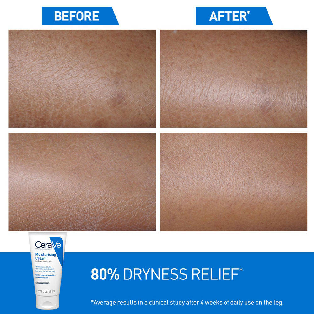 Moisturizer Cream For Dry Skin With Ceramides & Hyaluronic Acid For Barrier Repair | B20 - view 5