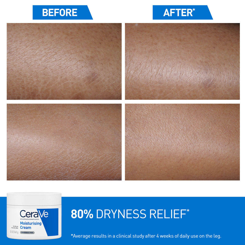 Moisturizer For Dry Skin, Barrier Repair Cream with Ceramides, Dermatologist recommended | FC3 - view 5