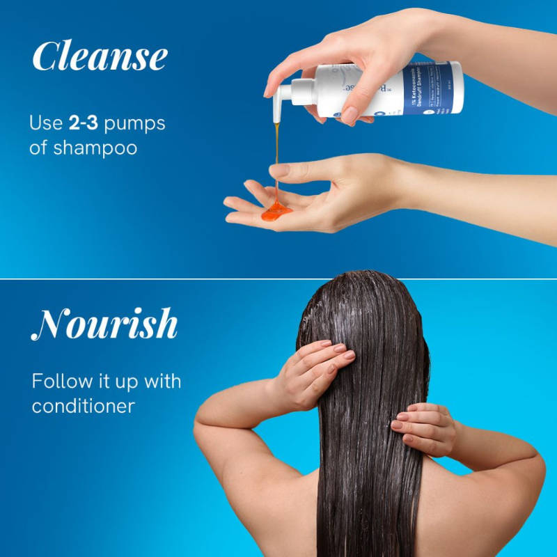 1% Ketoconazole Anti Dandruff Shampoo For Women | BWS9 - view 18