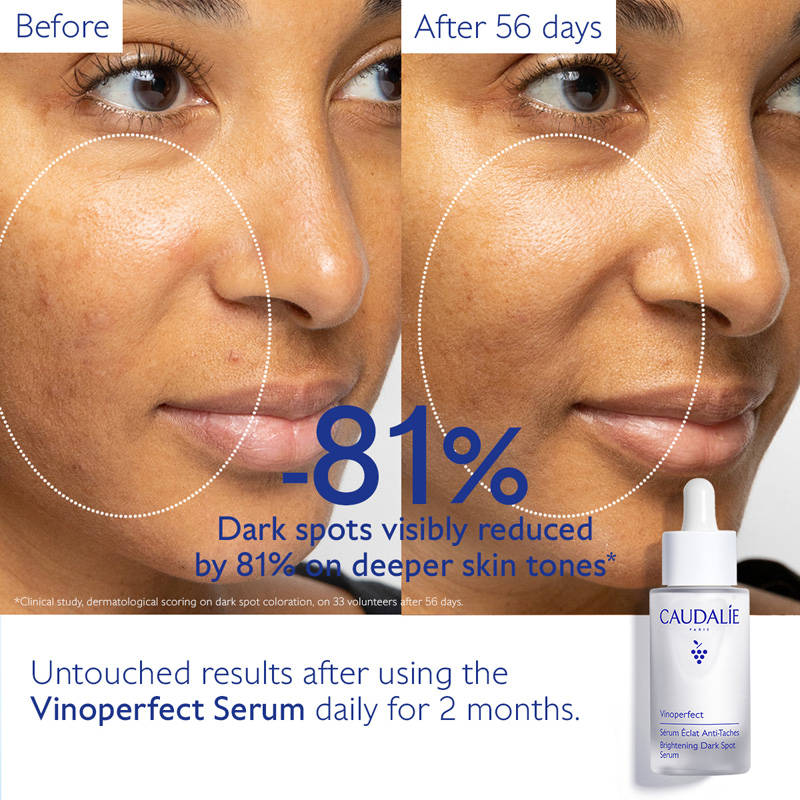 Vinoperfect Brightening Dark Spot Serum | Z8 - view 5