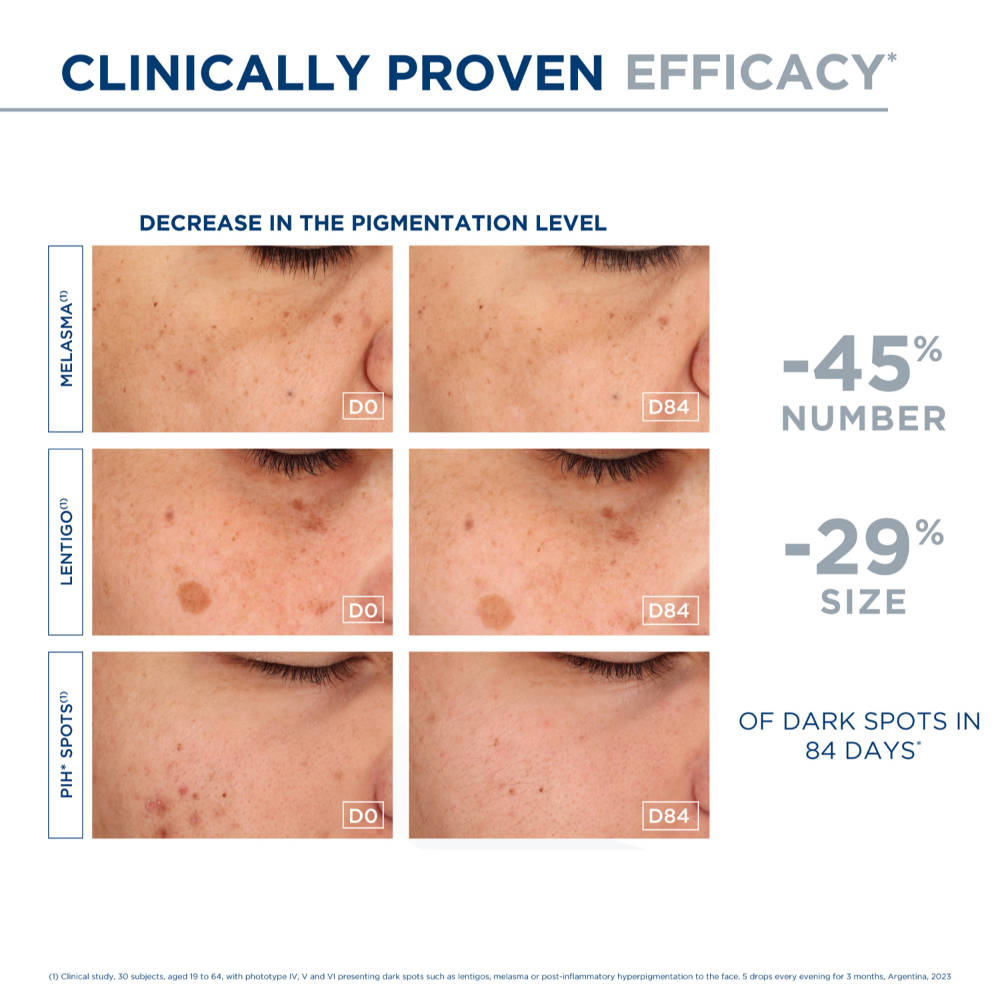 Brightening Serum - Pigmentbio C-Concentrate | Z8 - view 5