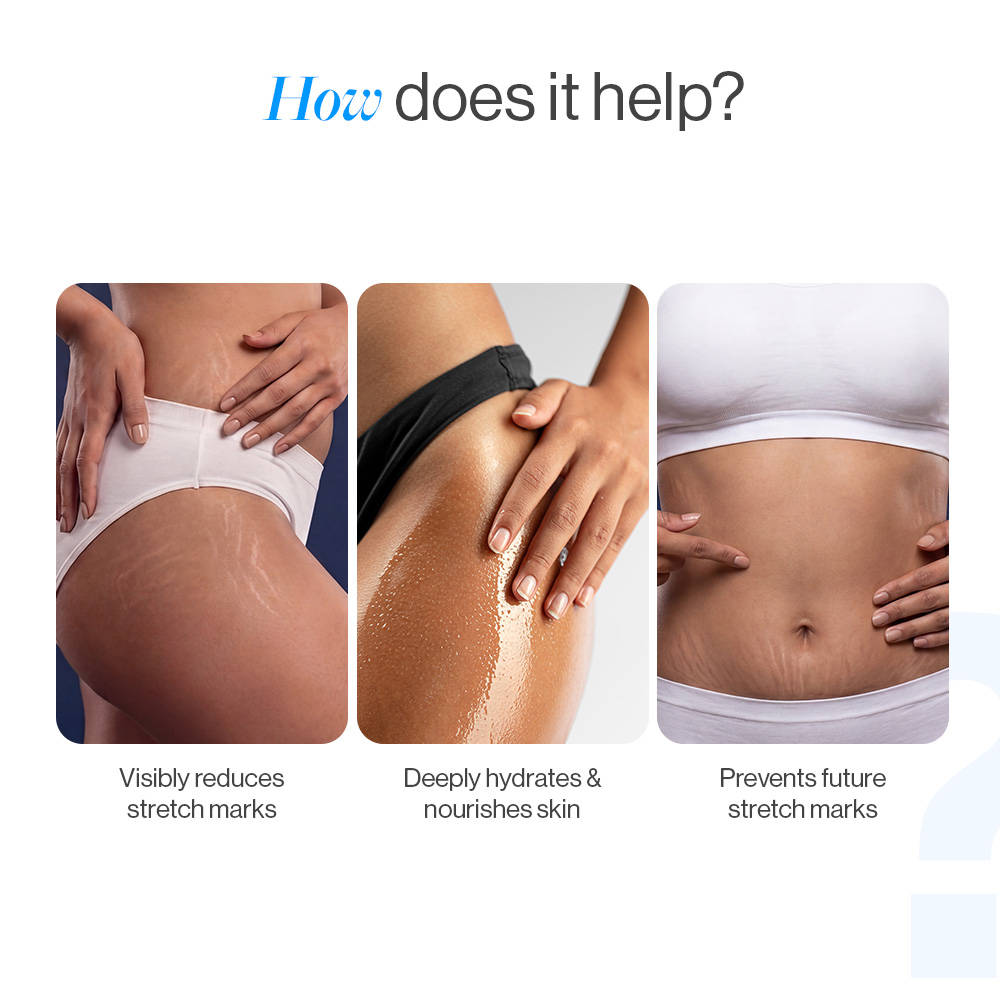 Anti Stretch Mark Roll-On Serum - Fades & Reduces Stretch Mark Appearance | BWS9 - view 4