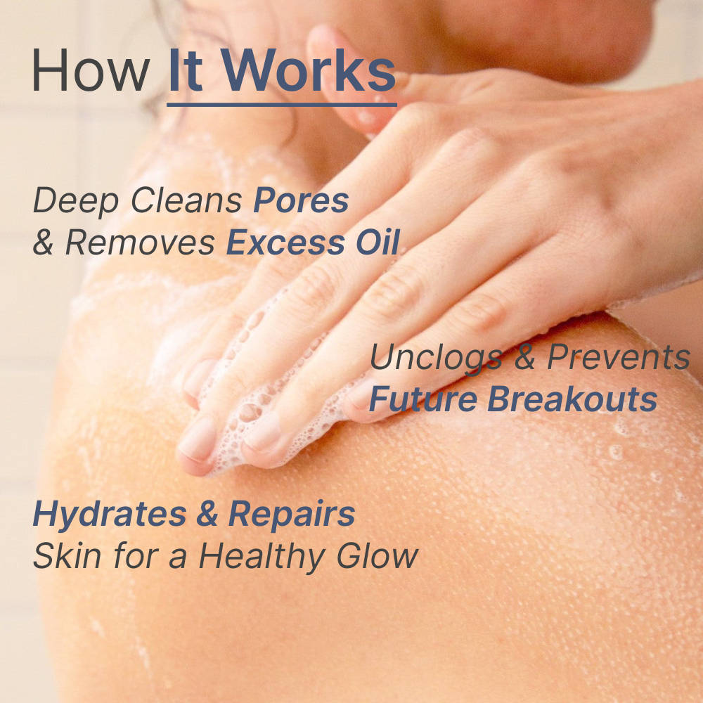 5% Benzoyl Peroxide Face & Body Acne Wash | B20 - view 4