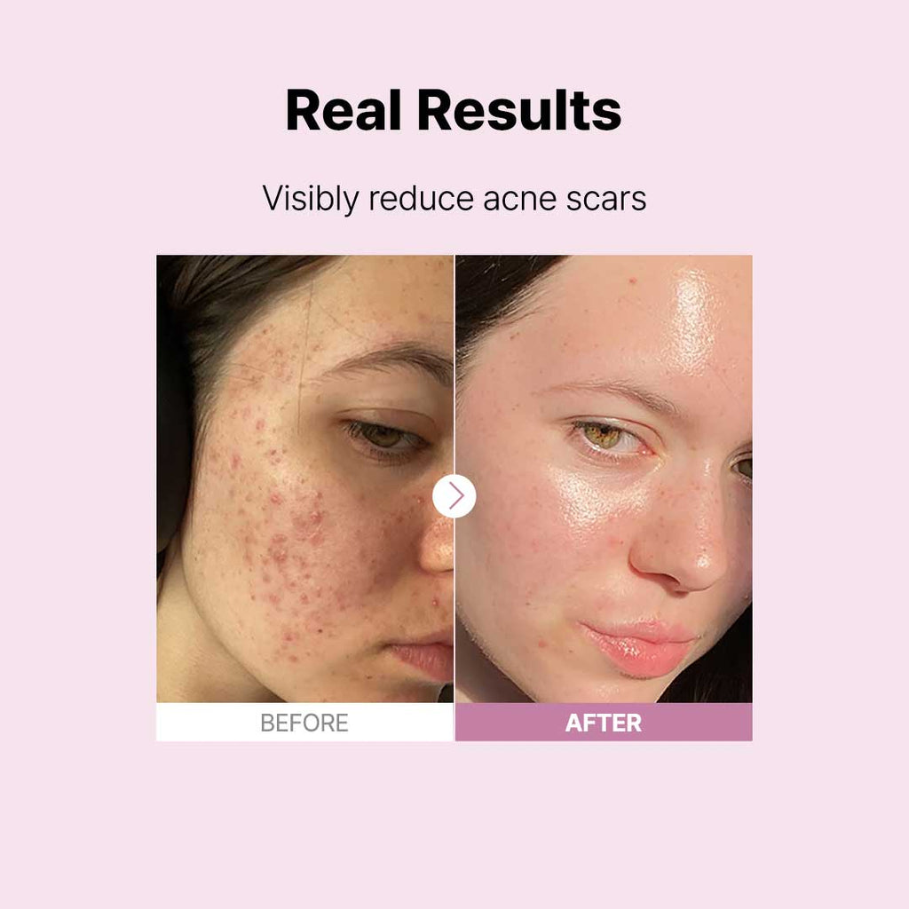 The Niacinamide 15 Serum | Z8 - view 8