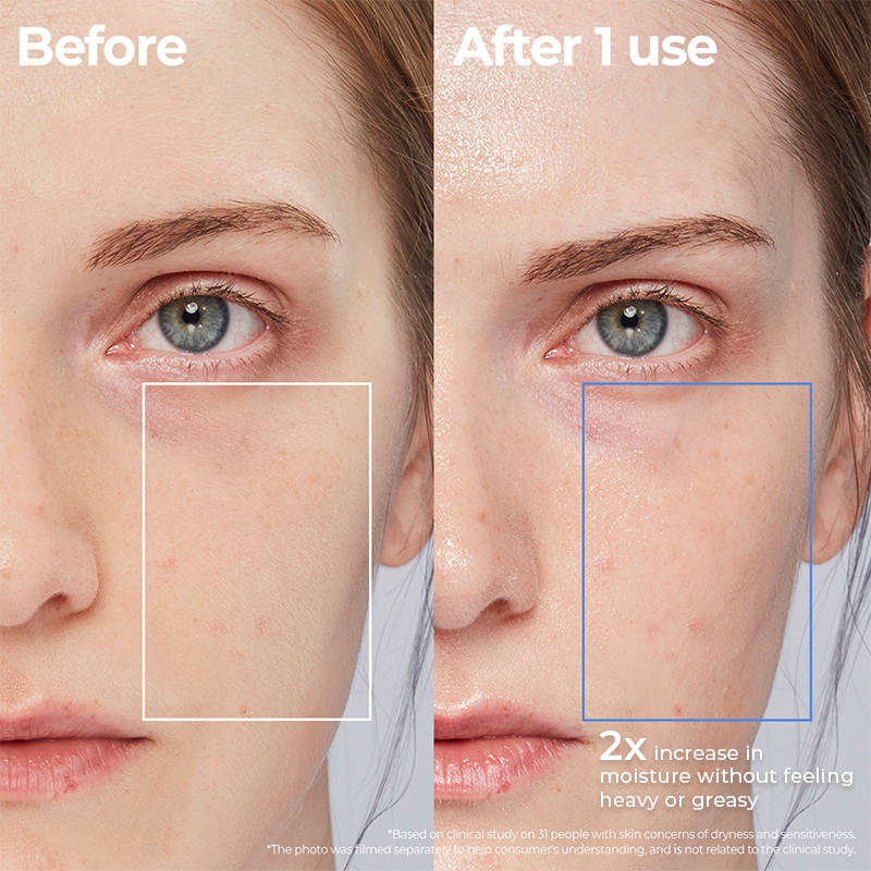 Atobarrier365 Lotion | FC3 - view 5