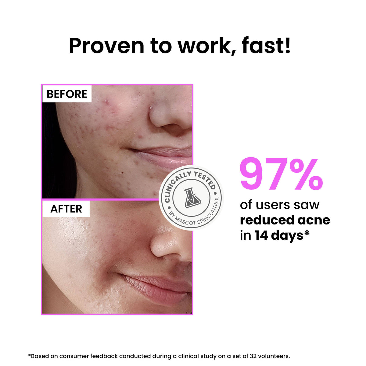 12% Niacinamide Brightening Face Serum, Fades Dark Spots & Acne marks, For Oil Control | Z8 - view 4