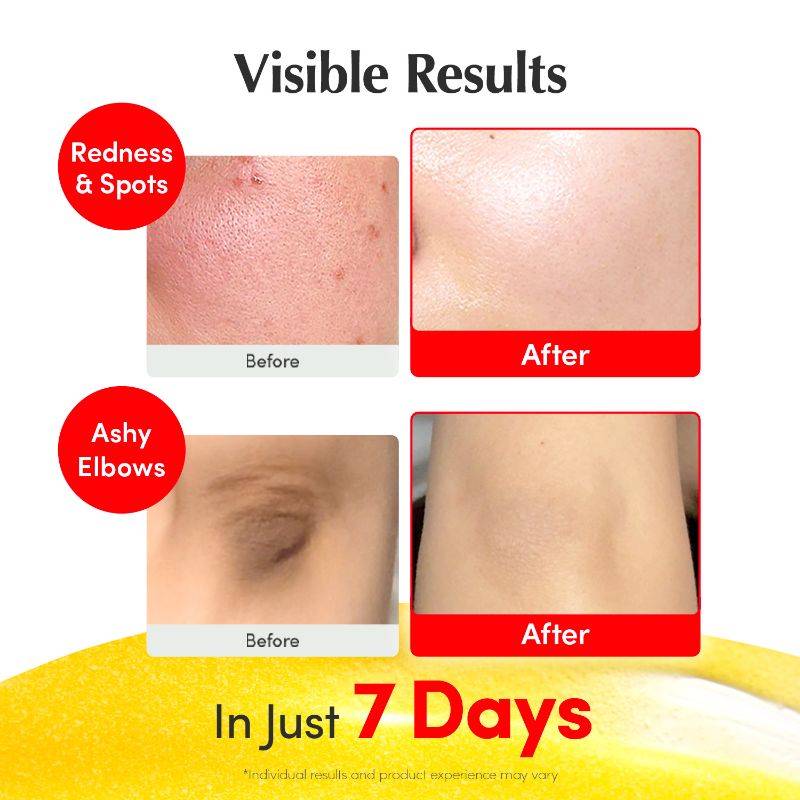 Vitamin C Face Serum – Niacinamide & Ceramides, Brightening & Hydrating | Z8 - view 4