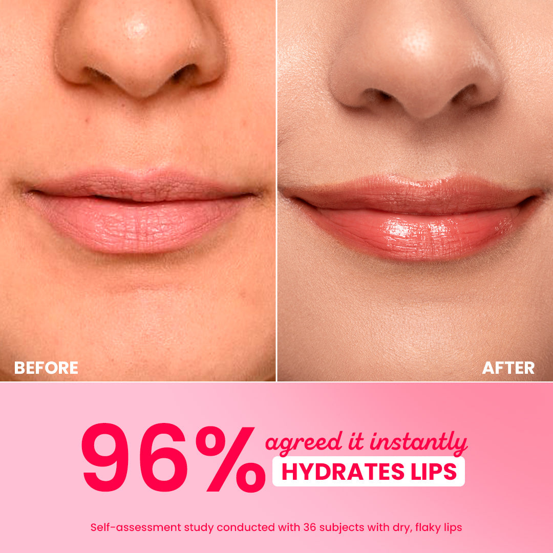 Barrier Repair Hydrating Lip Balm In-Vivo Tested SPF 50+ PA+++