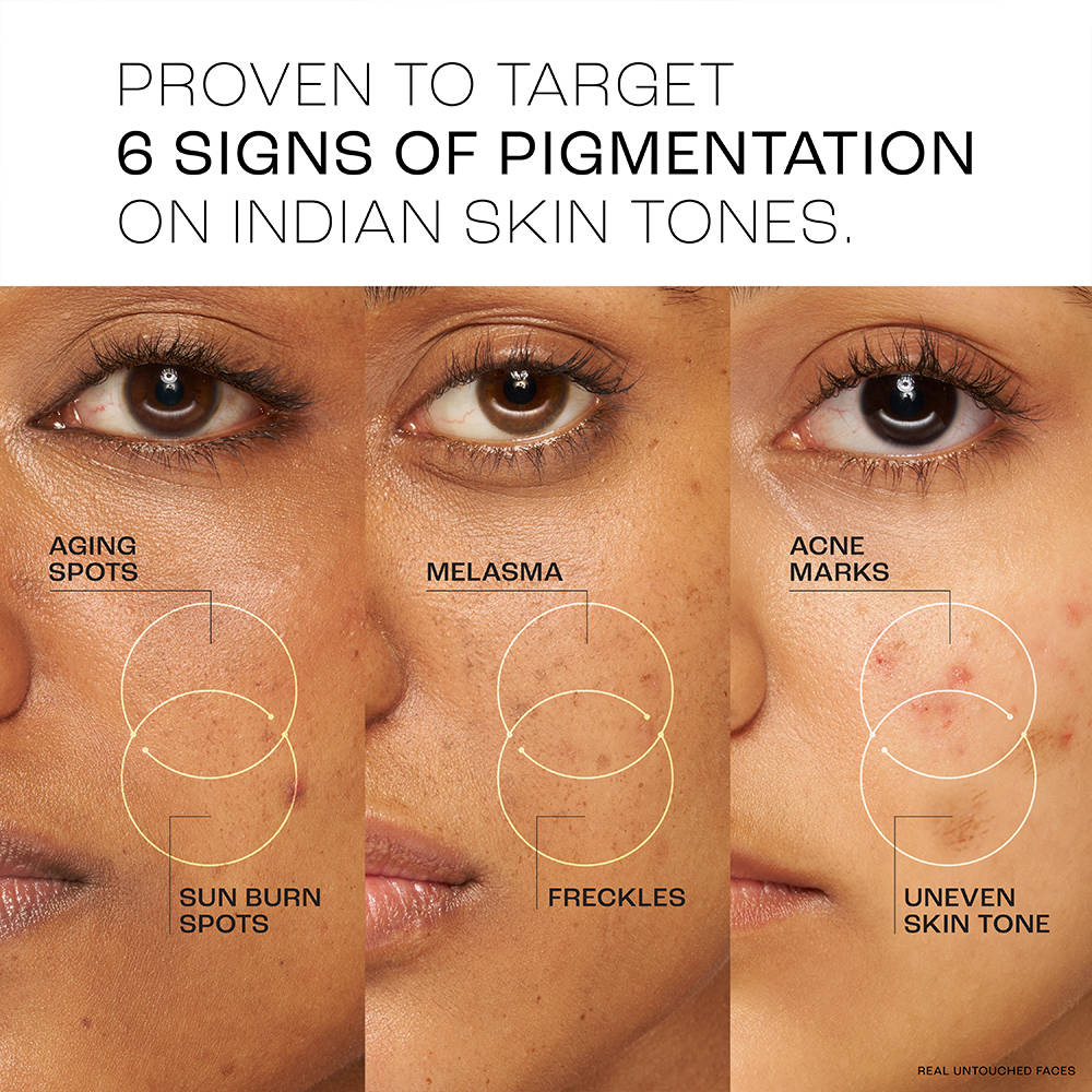 Absolute Perfect Radiance Serum With 7% Pure Niacinamide For 2X Skin Brightening | Z8 - view 6