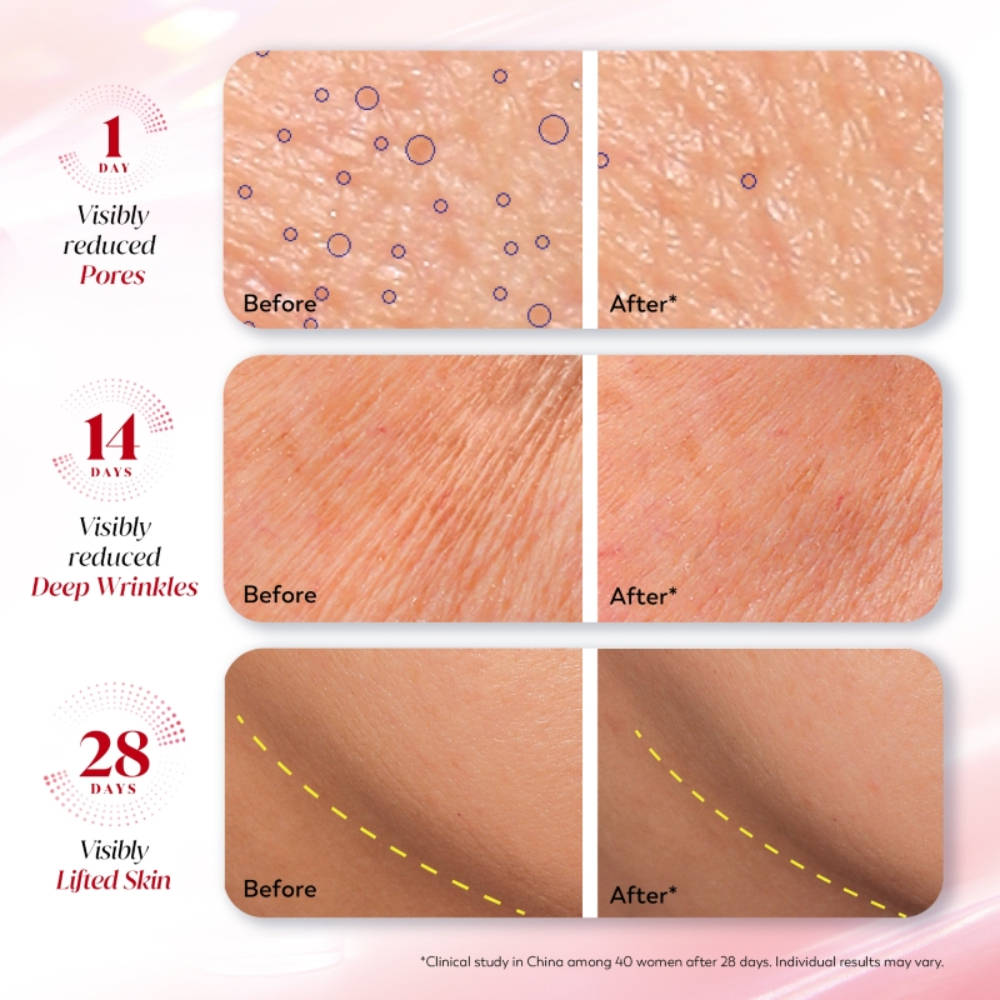 Ultra Firming Serum - Phca, Bakuchiol & Collagen Peptide | Z8 - view 4