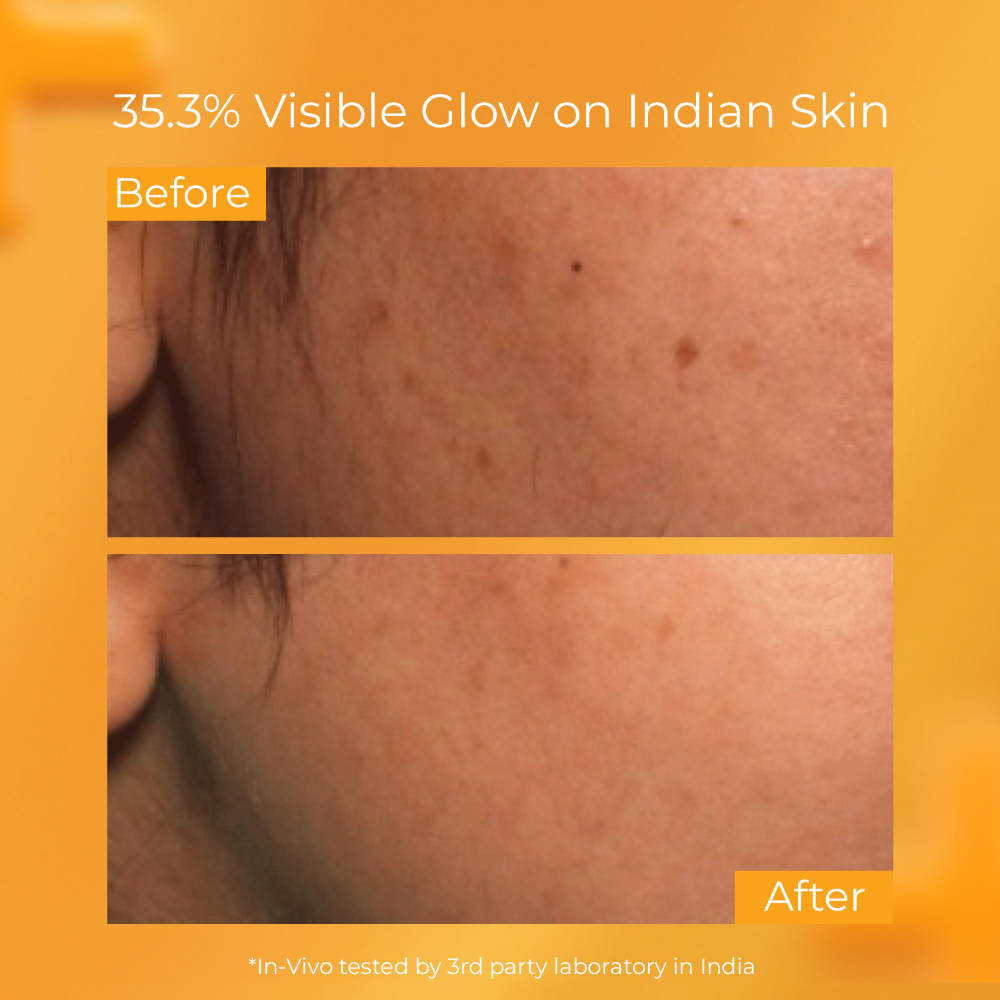 Detan Brightening Face Serum for Pigmentation & Dark Spots, Repairs Sun-Damaged Skin | Z8 - view 3