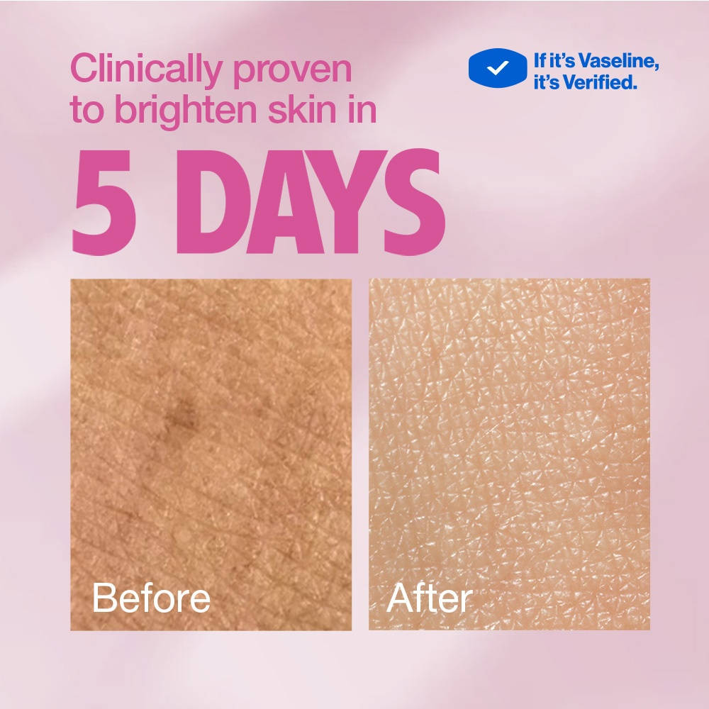 Gluta-Hya Dewy Radiance Lotion Bright | B20 - view 9