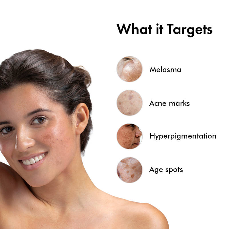 Advance Pigmentation Face Serum with Arbutin +Tranexamic Acid, Fights Hyperpigmentation | Z8 - view 4