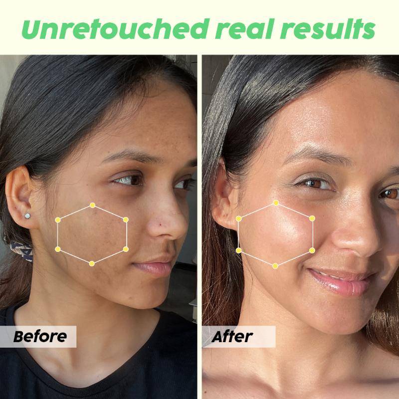 Guava Glow Combo With SPF 50+ Sunscreen & 3% Glycolic Acid Serum | PL1 - view 10