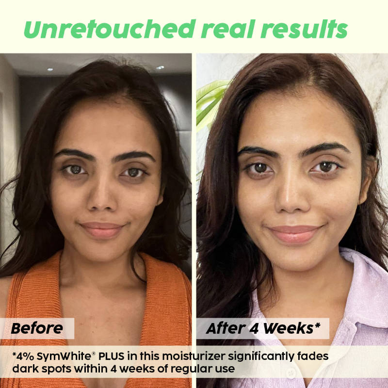 2% Alpha Arbutin Depigmentation Combo For Dark Spot Removal With Cleanser, Face Serum & Cream | PL1 - view 13
