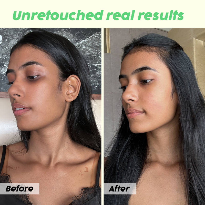 Guava Glow Regime With Smoothie Moisturizer & 10% Vitamin C Serum | PL1 - view 11