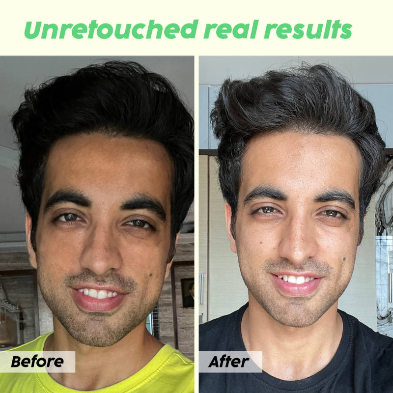 Guava Glow Regime With Smoothie Moisturizer & 10% Vitamin C Serum | PL1 - view 12